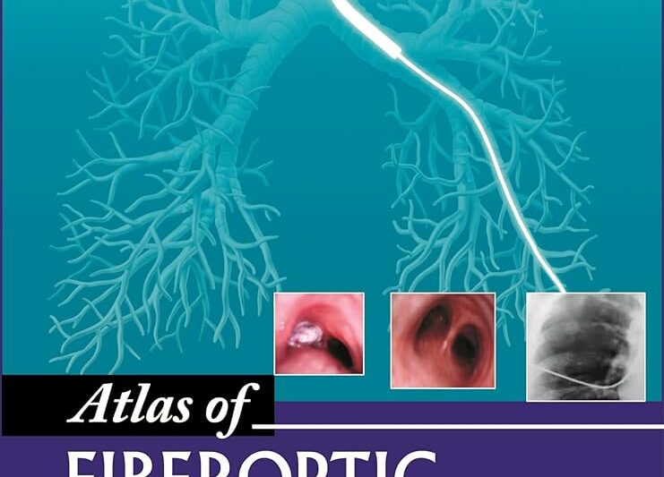 Атлас Fiberoptic Bronchoscopy 2014